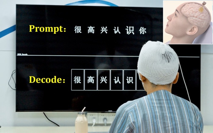 脑机接口的未来：马斯克确认2025年Neuralink将为20至30名患者实施植入_马斯克脑植入芯片的价格_马斯克发明植入脑机接口